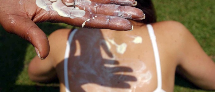 облезла кожа после загара горит кожа после загара