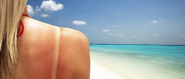 облезла кожа после загара пятна на коже после загара