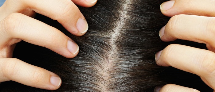 что делать, если седеют волосы в 20 лет