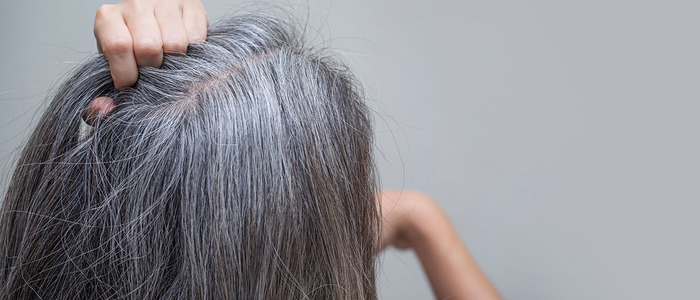 что делать, если седеют волосы в 20 лет