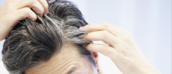 седеют волосы у девушек в 20 лет