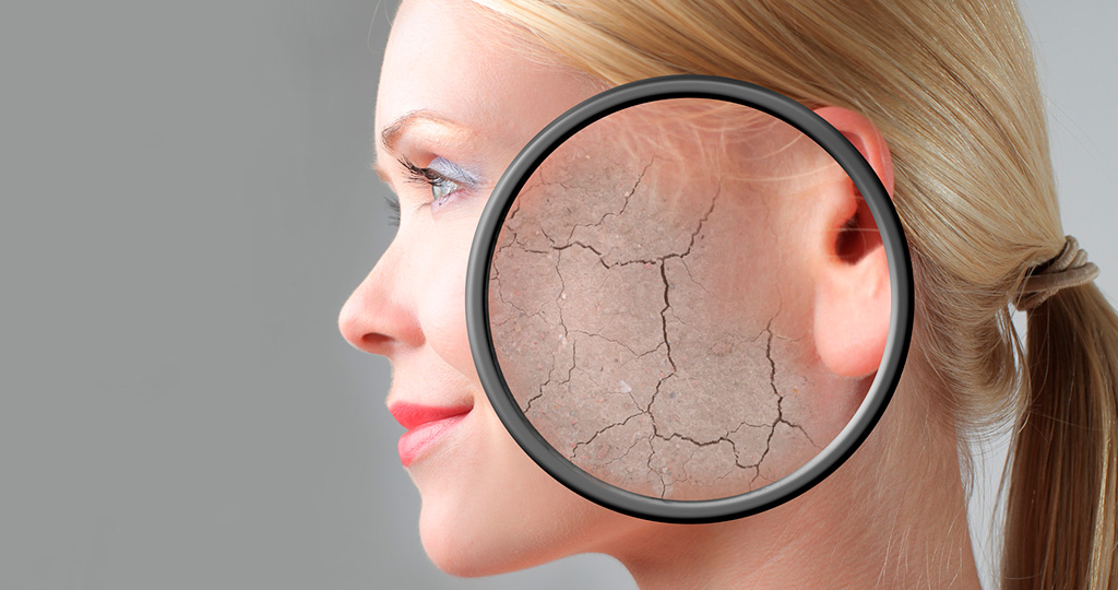 Причины сухой кожи лица Признаки сухой кожи лица